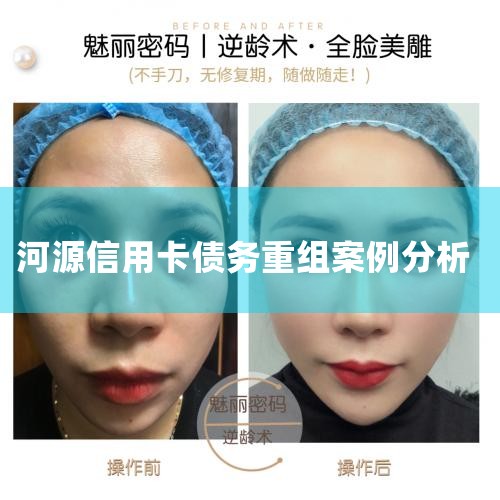 ���ÿ�����ûǮ����õĴ����������ÿ�����ûǮ�����������н���Э��,���Լ�û�л������������˵���,Ȼ��������ӳ��������ޡ����ڳ���Ƿ�������,ͬʱ���Գ�������ͣϢ���ˡ���չ����:���ÿ�������ָ���ֿ�